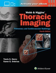 Webb & Higgins Thoracic Imaging: Print + eBook with Multimedia by KAREN GOMES OR